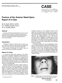 Fracture of the Anterior Nasal Spine: Report of a Case