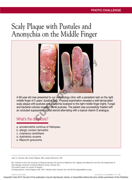 Scaly Plaque with Pustules and Anonychia on the Middle Finger