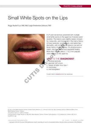Small White Spots on the Lips