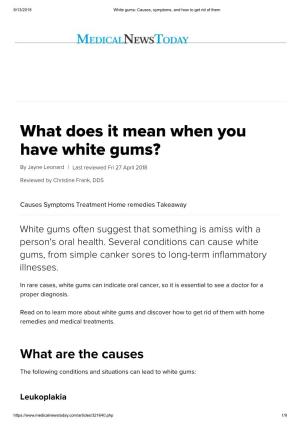What Does It Mean When You Have White Gums?
