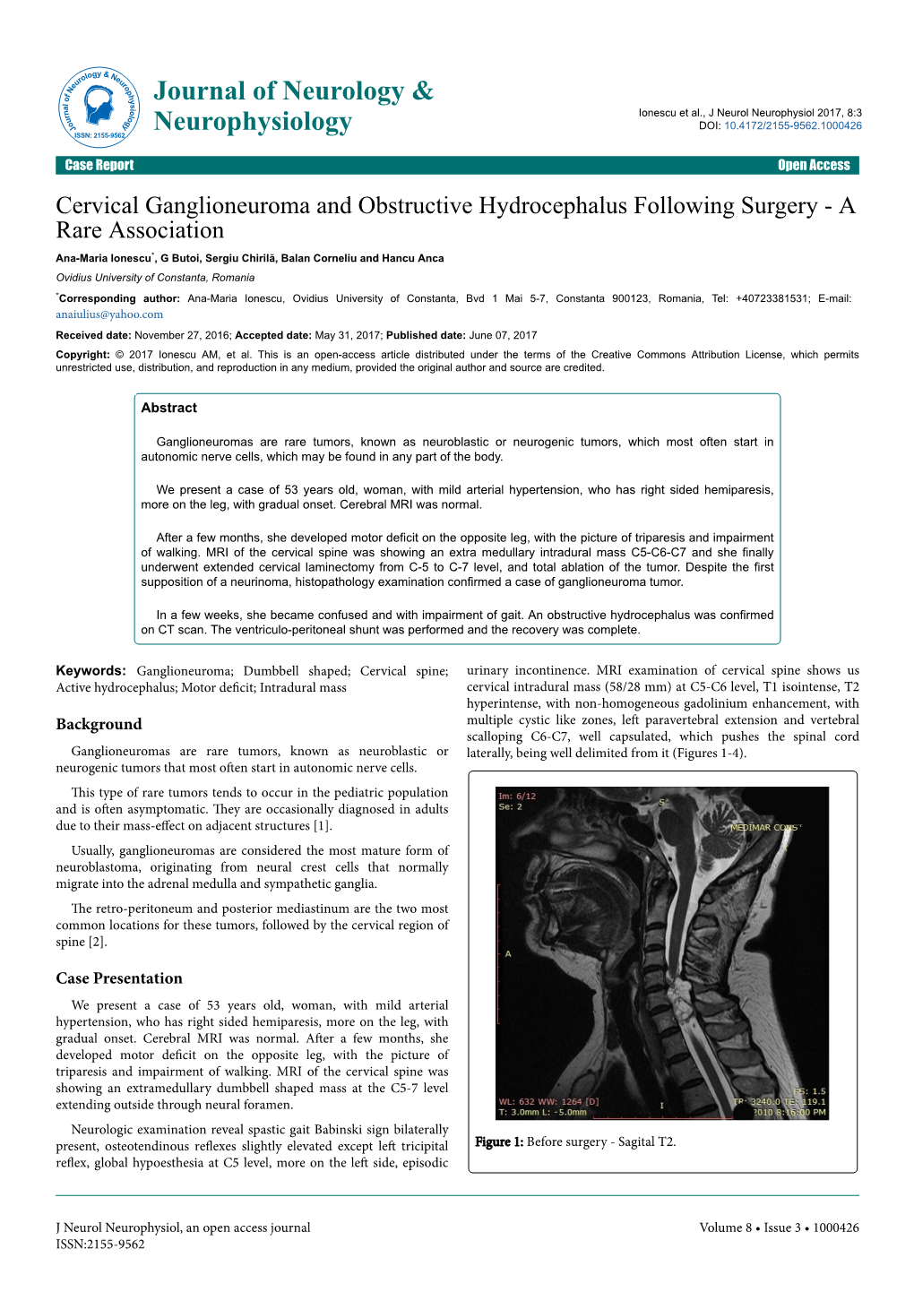 Cervical Ganglioneuroma and Obstructive Hydrocephalus Following Surgery