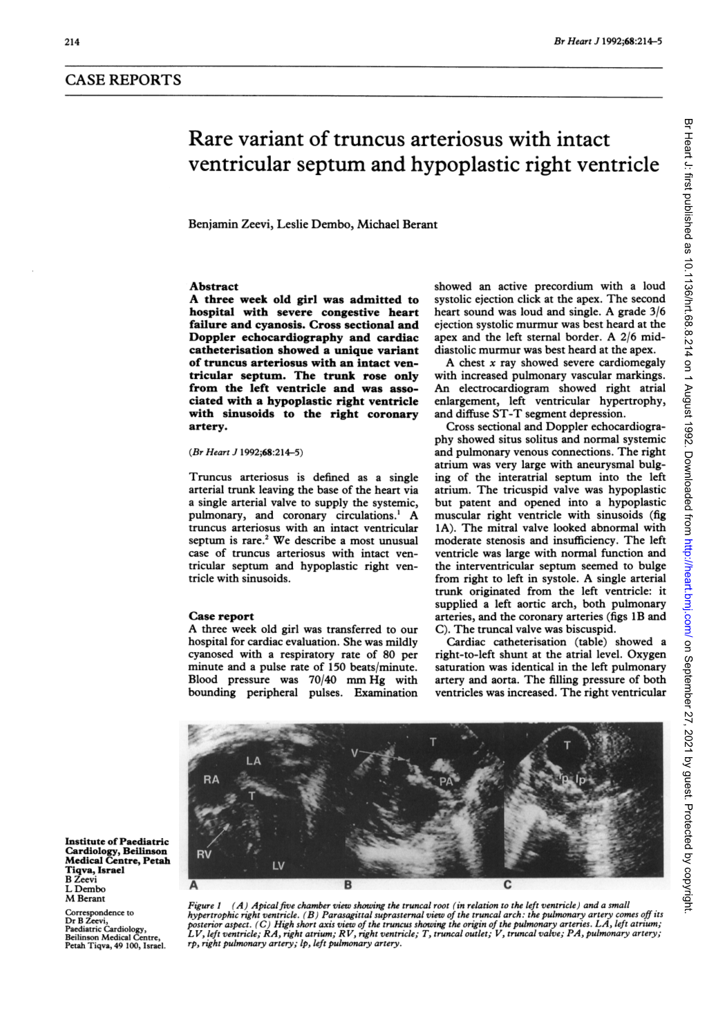 Rare Variant Oftruncus Arteriosus with Intact Ventricular Septum and Hypoplastic Right Ventricle