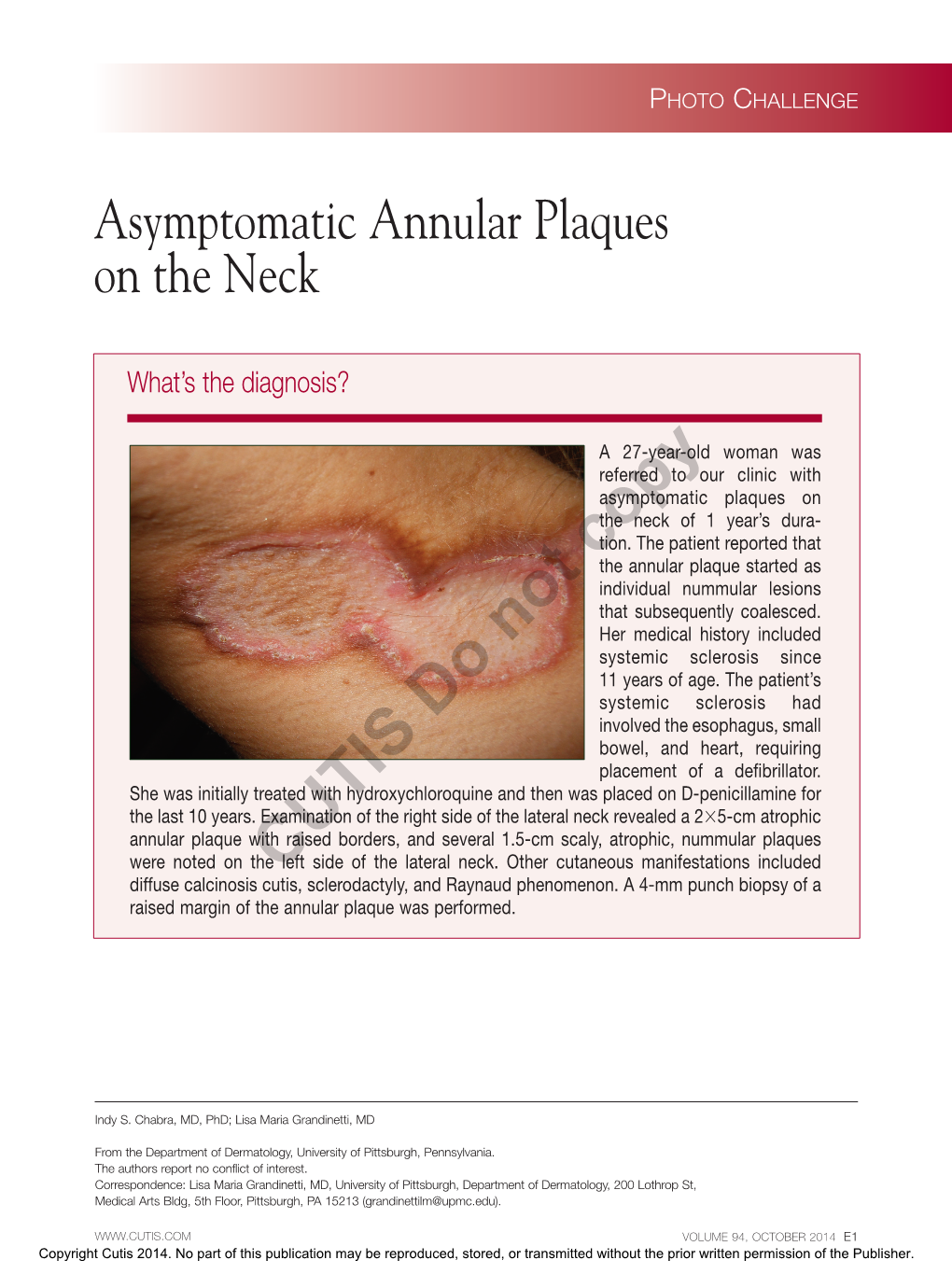 Asymptomatic Annular Plaques on the Neck