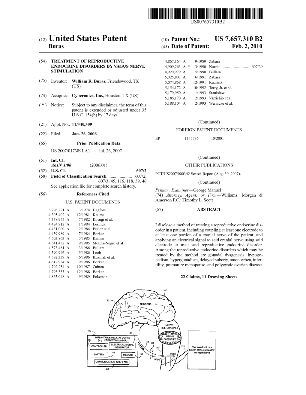 United States Patent (10) Patent No.: US 7,657,310 B2 Buras (45) Date of Patent: Feb
