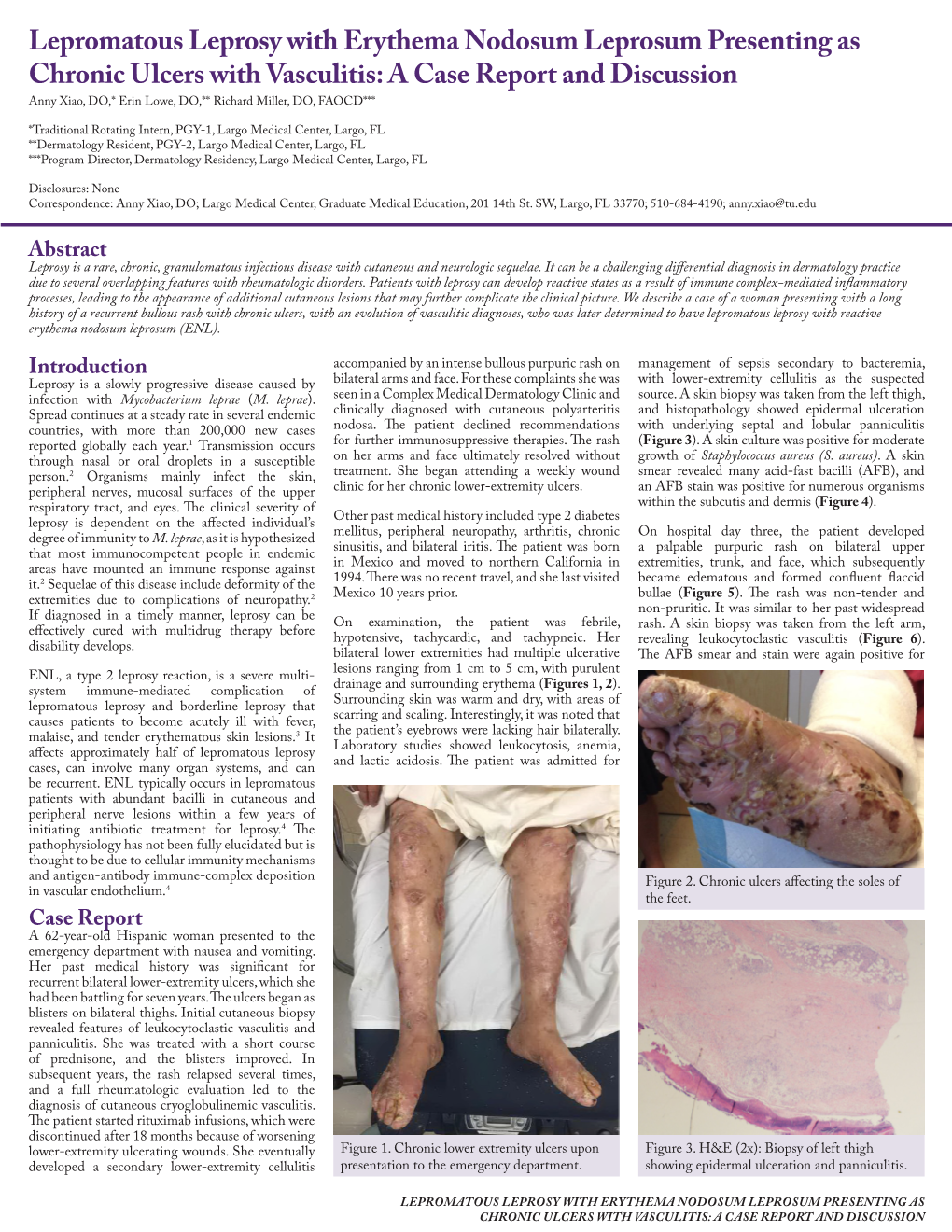 Lepromatous Leprosy with Erythema Nodosum Leprosum Presenting As - DocsLib