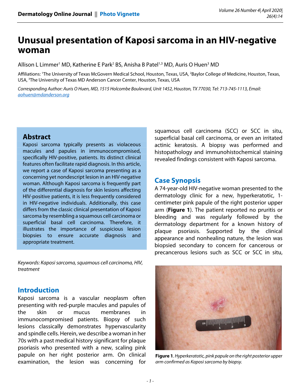 Unusual Presentation of Kaposi Sarcoma in an HIV-Negative Woman