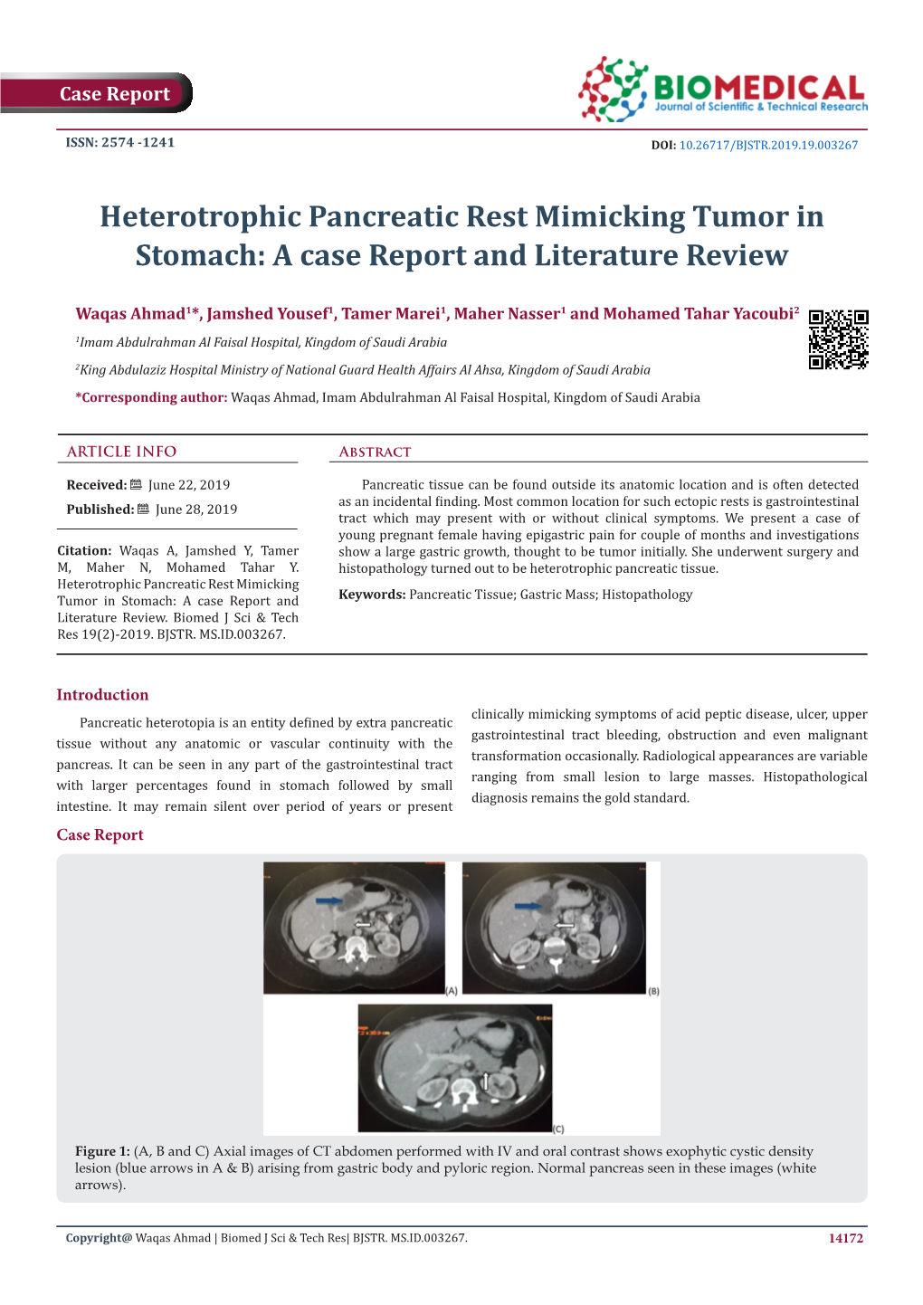 Heterotrophic Pancreatic Rest Mimicking Tumor in Stomach: a Case Report and Literature Review