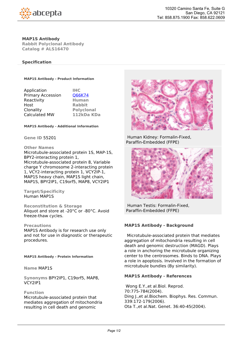 MAP1S Antibody Rabbit Polyclonal Antibody Catalog # ALS16470