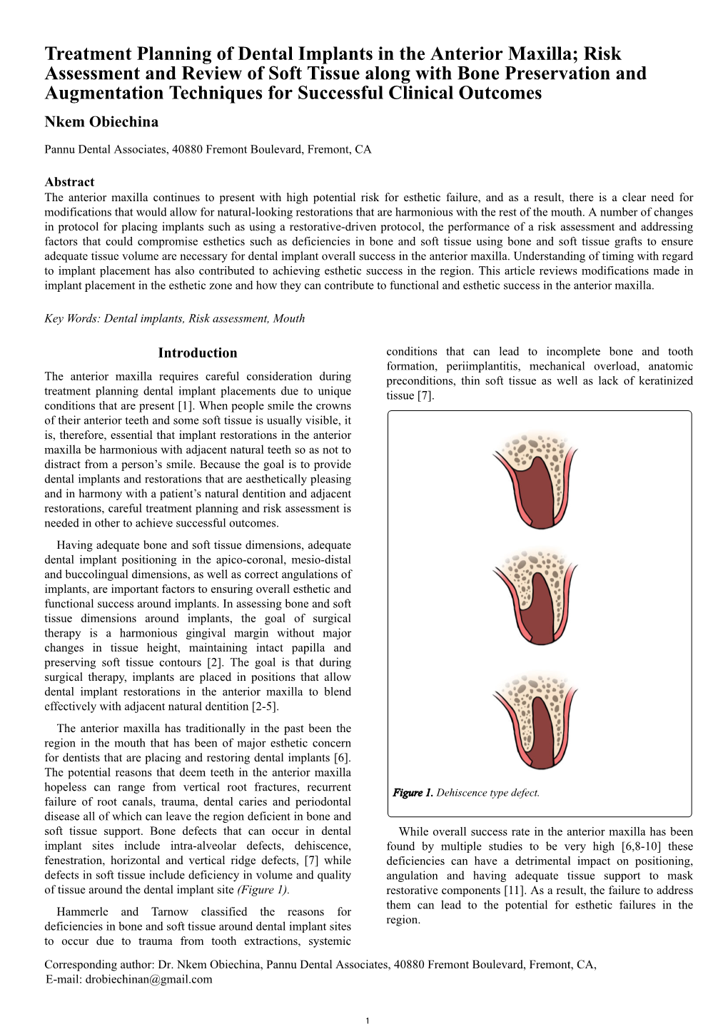 Treatment Planning of Dental Implants in the Anterior Maxilla