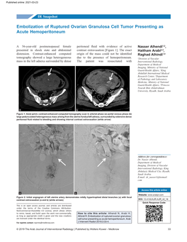 Embolization of Ruptured Ovarian Granulosa Cell Tumor Presenting As Acute Hemoperitoneum
