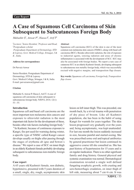 A Case of Squamous Cell Carcinoma of Skin Subsequent to Subcutaneous Foreign Body Mubashir S1, Anwar P2, Hassa I3, Arif T4