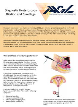 Diagnostic Hysteroscopy Dilation and Curettage