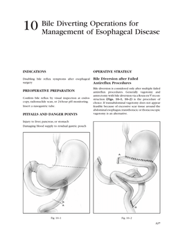 10 Bile Diverting Operations for Management of Esophageal Disease