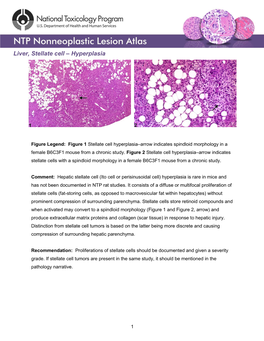 Liver, Stellate Cell – Hyperplasia