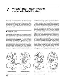 Visceral Situs, Heart Position, and Aortic Arch Position 69