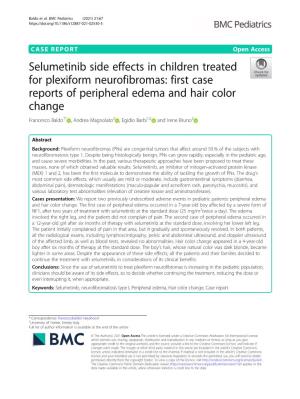 Selumetinib Side Effects in Children Treated for Plexiform Neurofibromas