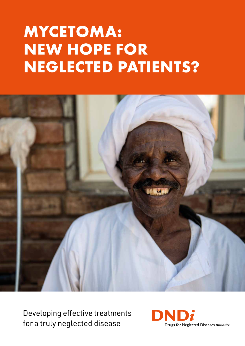 Mycetoma: New Hope for Neglected Patients?