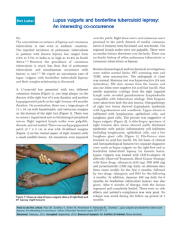 Lupus Vulgaris and Borderline Tuberculoid Leprosy: an Interesting Co-Occurrence