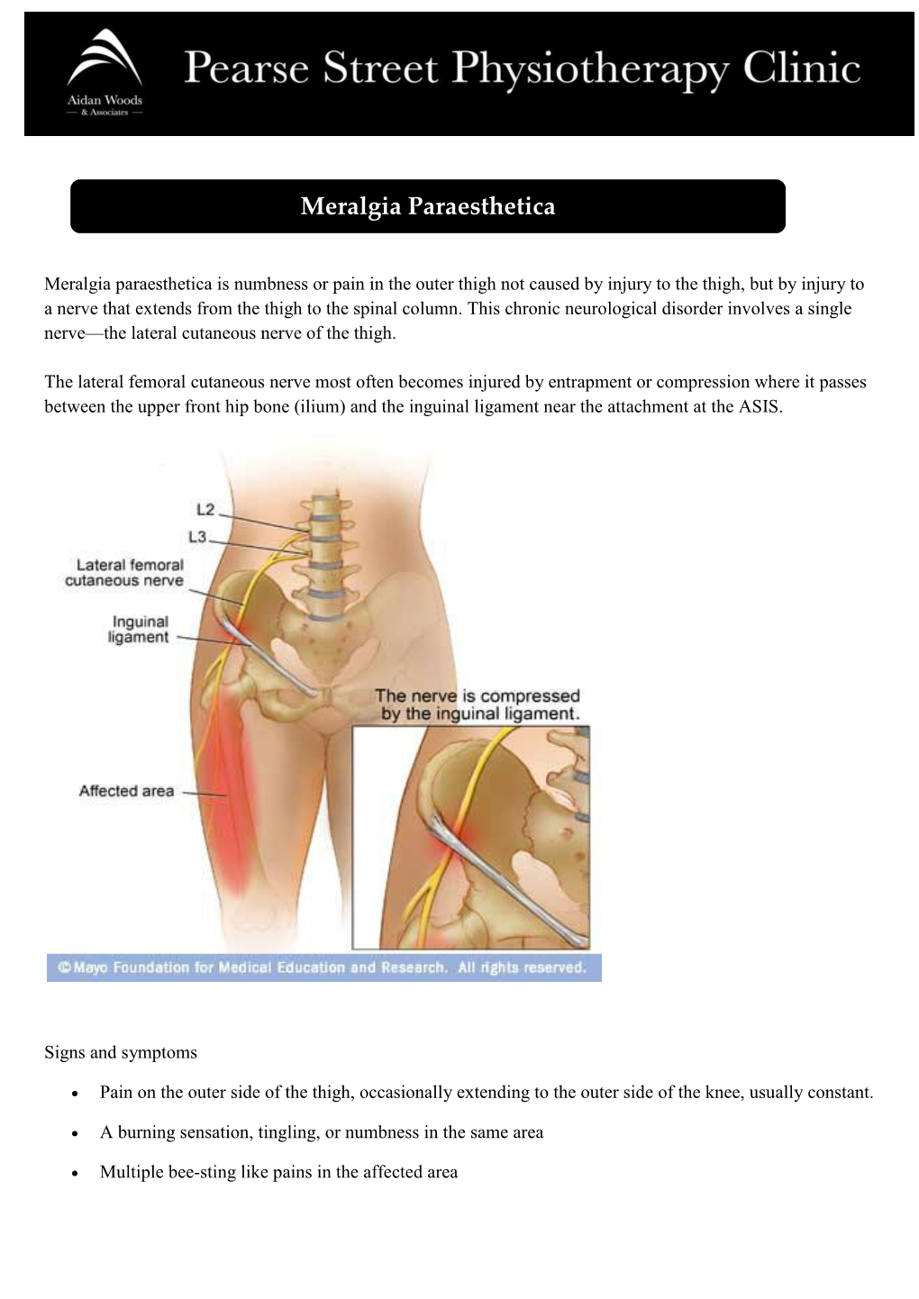 Meralgia Paraesthetica