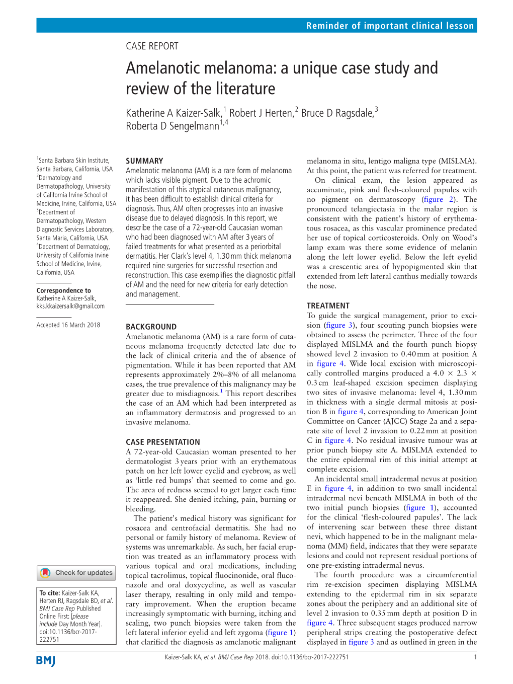 Amelanotic Melanoma: a Unique Case Study and Review of the Literature Katherine a Kaizer-Salk,1 Robert J Herten,2 Bruce D Ragsdale,3 Roberta D Sengelmann1,4