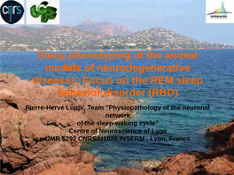 Focus on the REM Sleep Behavior Disorder (RBD)