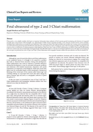 Fetal Ultrasound of Type 2 and 3 Chiari Malformation