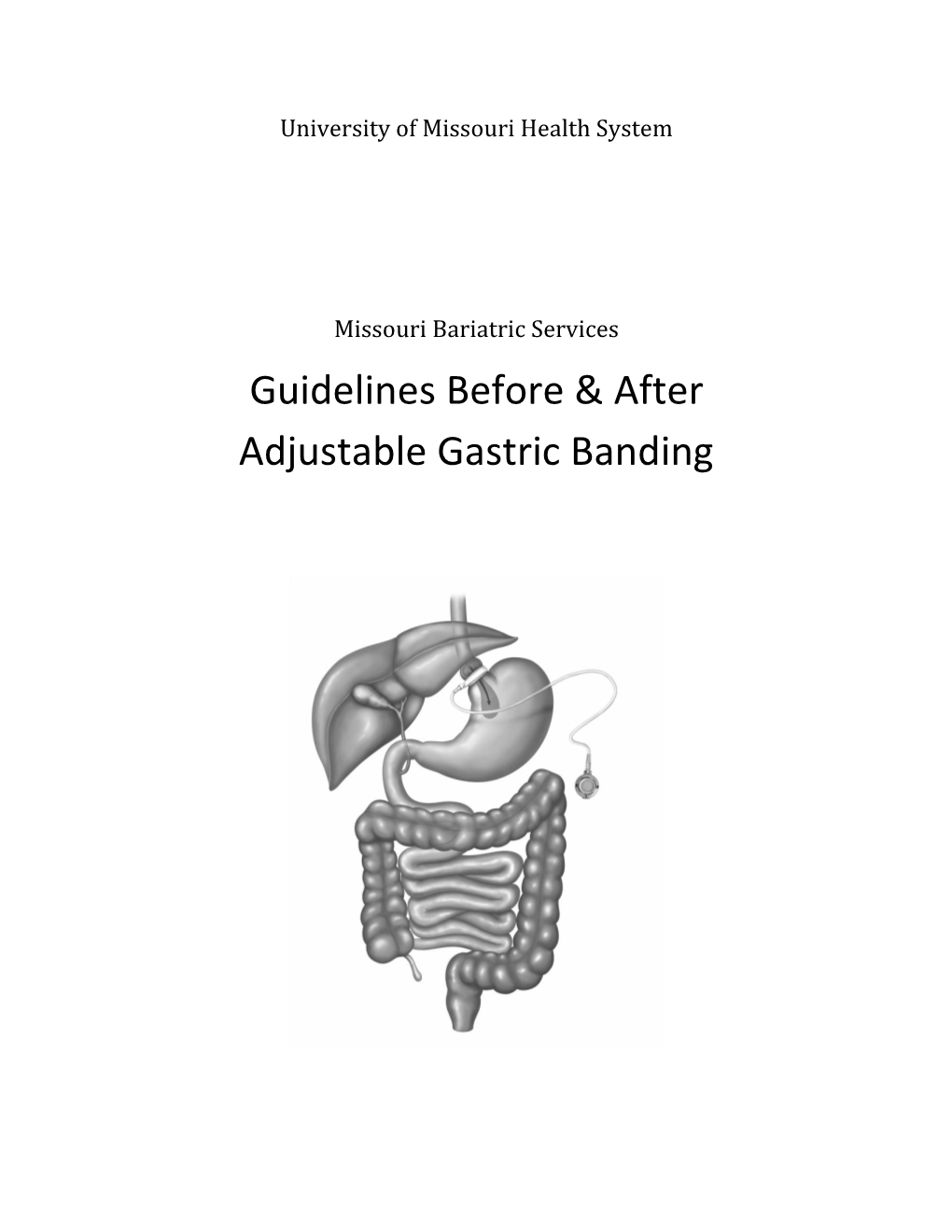 Guidelines Before & After Adjustable Gastric Banding