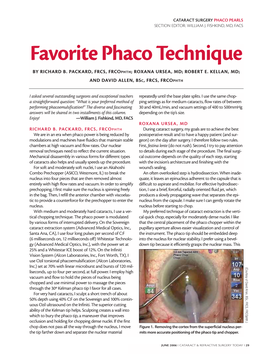 Favorite Phaco Technique