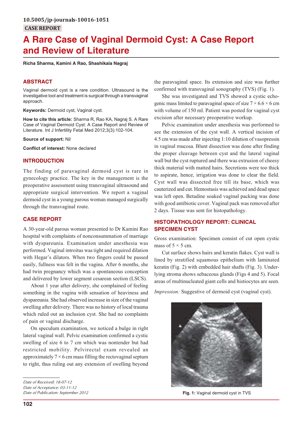 A Rare Case Of Vaginal Dermoid Cyst A Case Report And Review Of