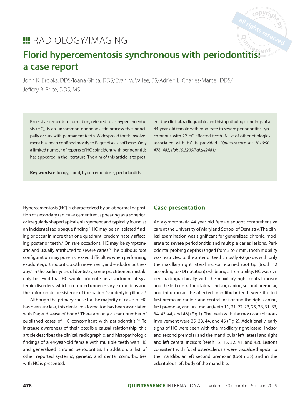 Florid Hypercementosis Synchronous with Periodontitis: a Case Report John K