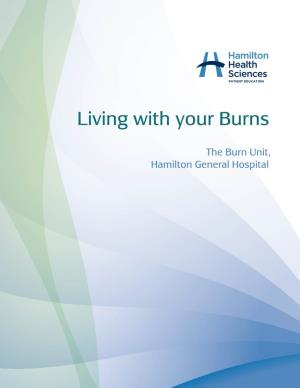 Living with Your Burns