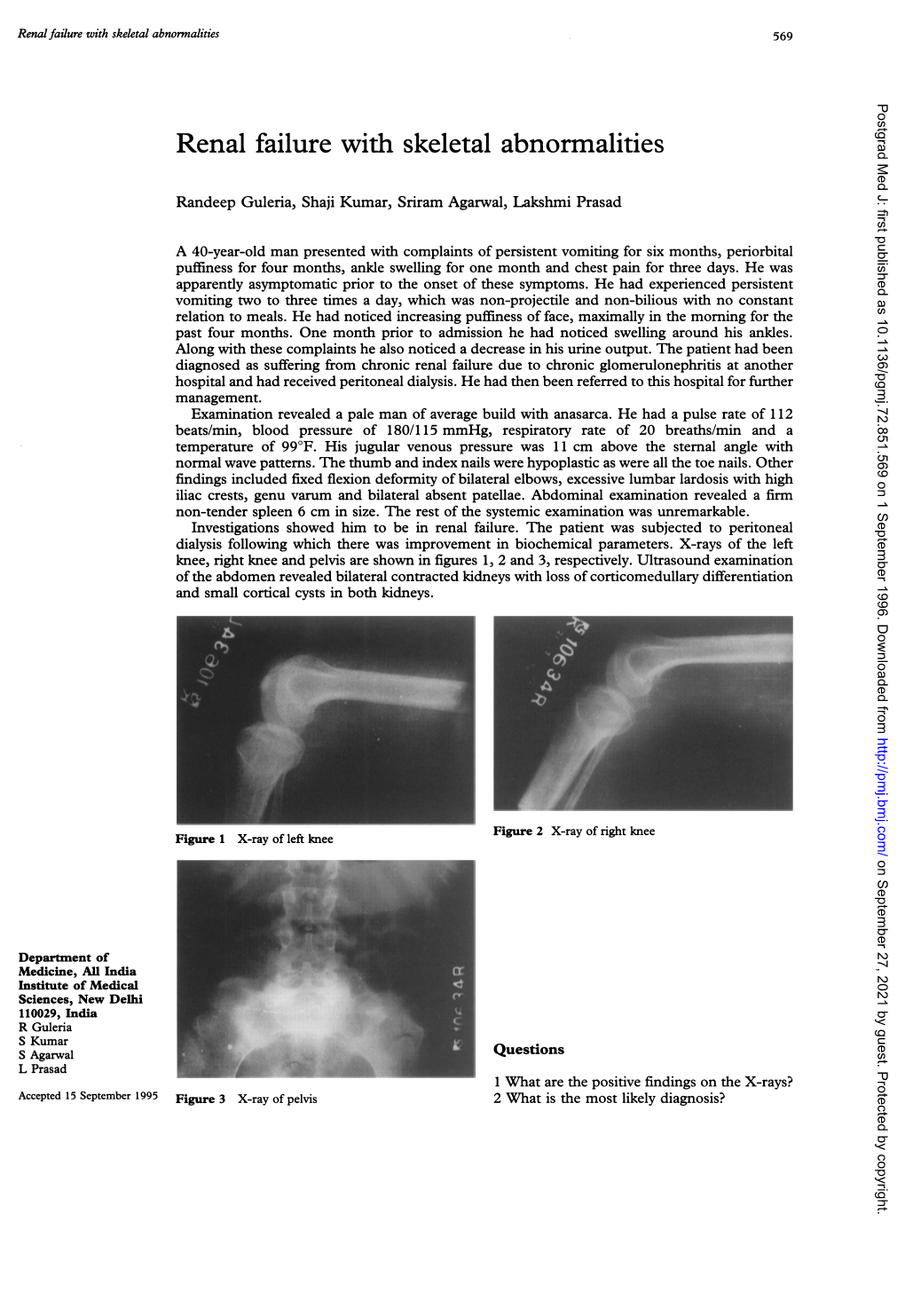 Renal Failure with Skeletal Abnormalities