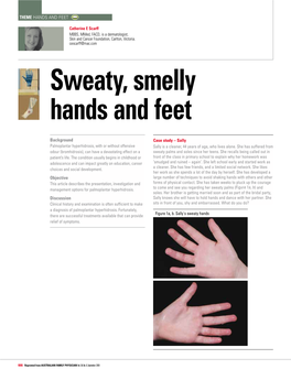 Sweaty, Smelly Hands and Feet