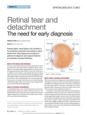 Retinal Tear and Detachment. the Need for Early Diagnosis