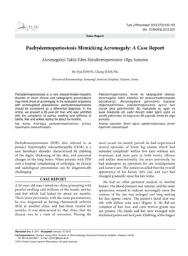 Pachydermoperiostosis Mimicking Acromegaly: a Case Report