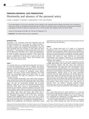 Hemimelia and Absence of the Peroneal Artery