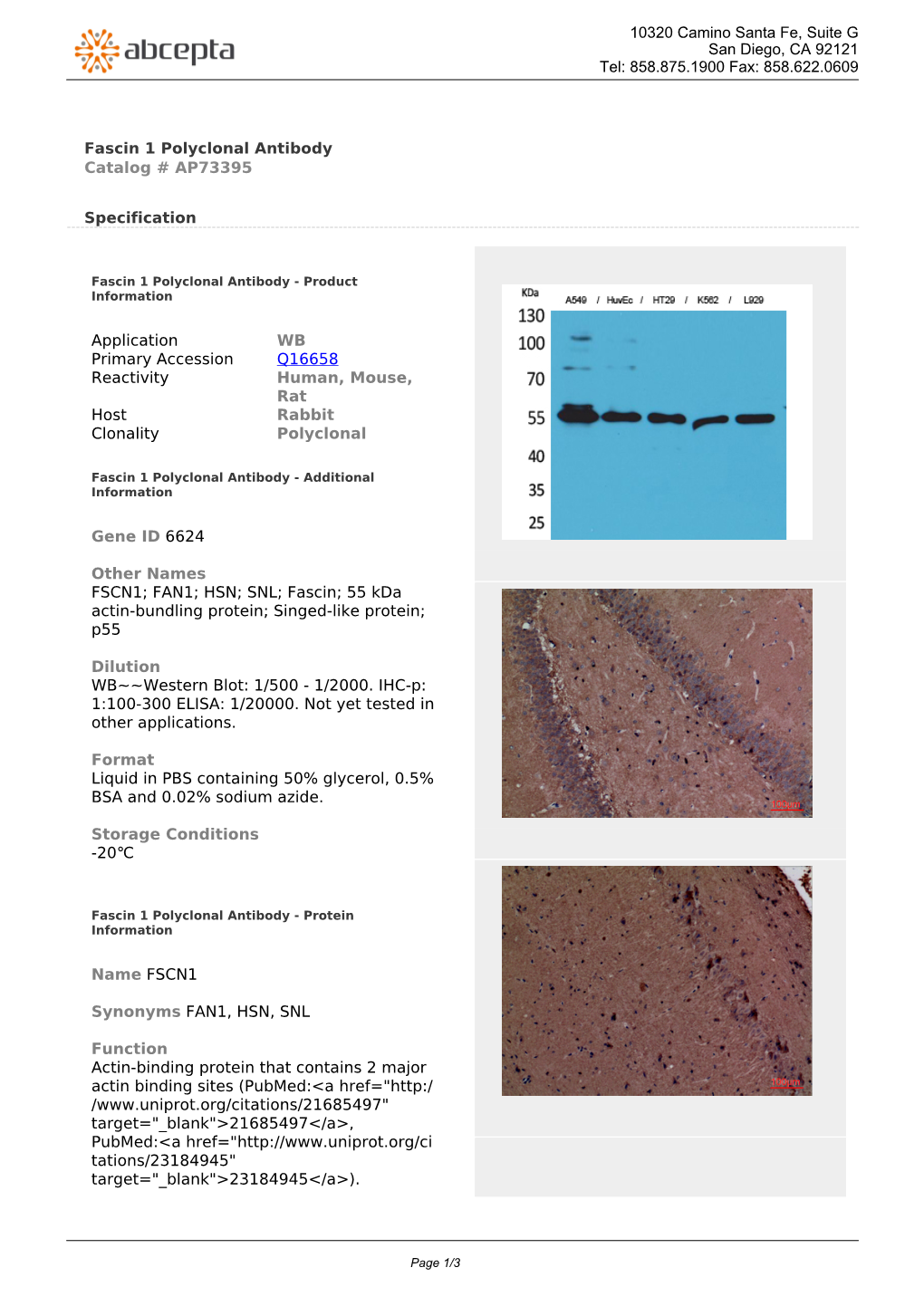 Fascin 1 Polyclonal Antibody Catalog # AP73395