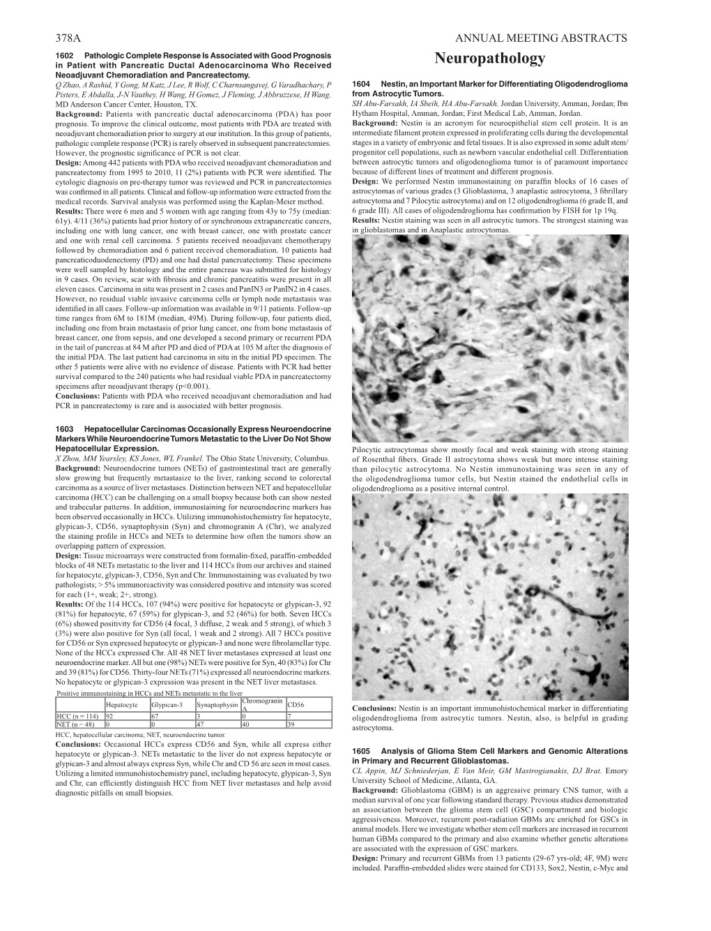 Neuropathology Neoadjuvant Chemoradiation and Pancreatectomy