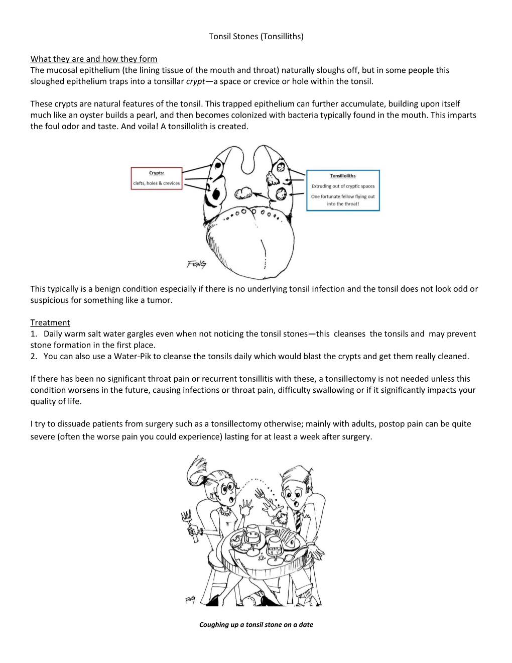 Tonsil Stones (Tonsilliths) What They Are and How They Form the Mucosal