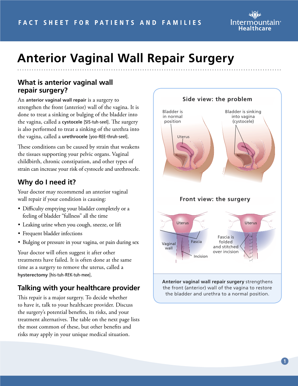 Anterior Vaginal Wall Repair Surgery Fact Sheet