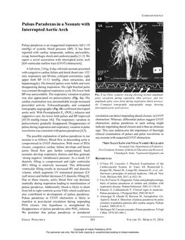 Pulsus Paradoxus in a Neonate with Interrupted Aortic Arch