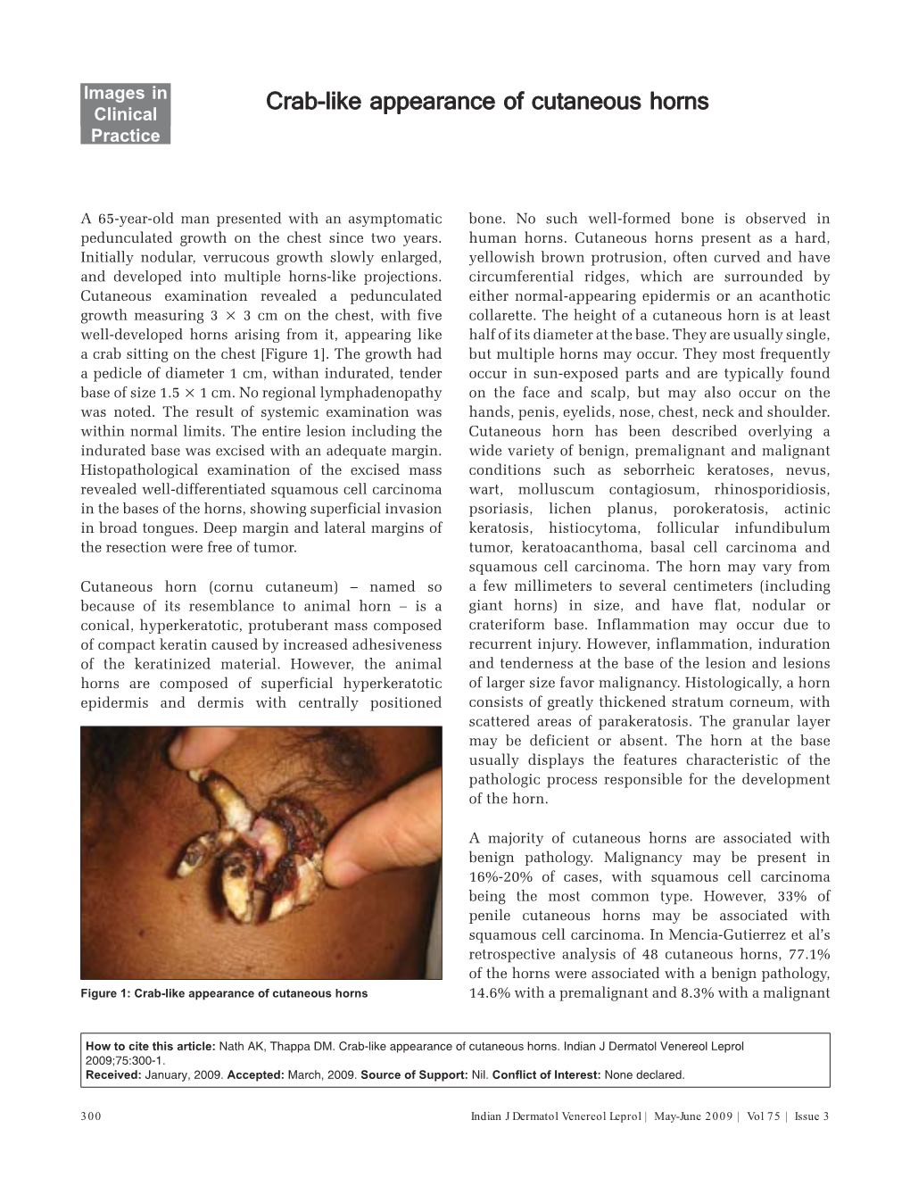 Crab-Like Appearance of Cutaneous Horns 14.6% with a Premalignant and 8.3% with a Malignant