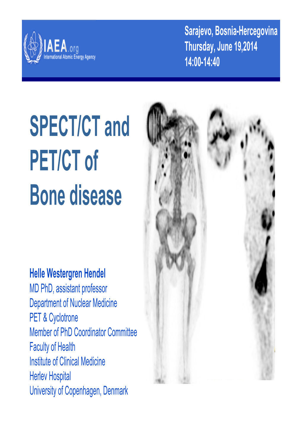 SPECT/CT and PET/CT of Bone Disease