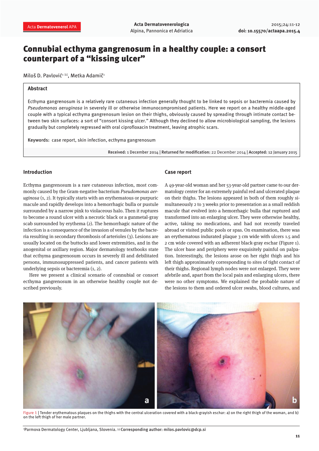 Connubial Ecthyma Gangrenosum in a Healthy Couple: a Consort Counterpart of a “Kissing Ulcer”