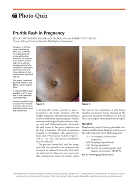 Pruritic Rash in Pregnancy JAMES S