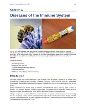 Diseases of the Immune System 813