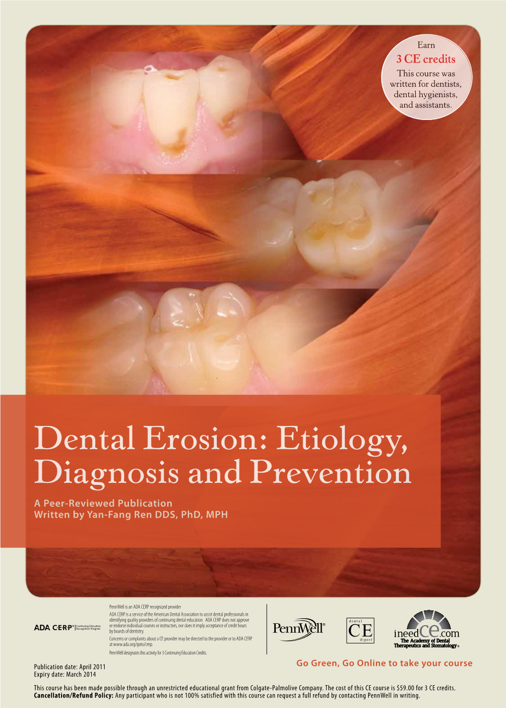 Dental Erosion: Etiology, Diagnosis and Prevention a Peer-Reviewed Publication Written by Yan-Fang Ren DDS, Phd, MPH