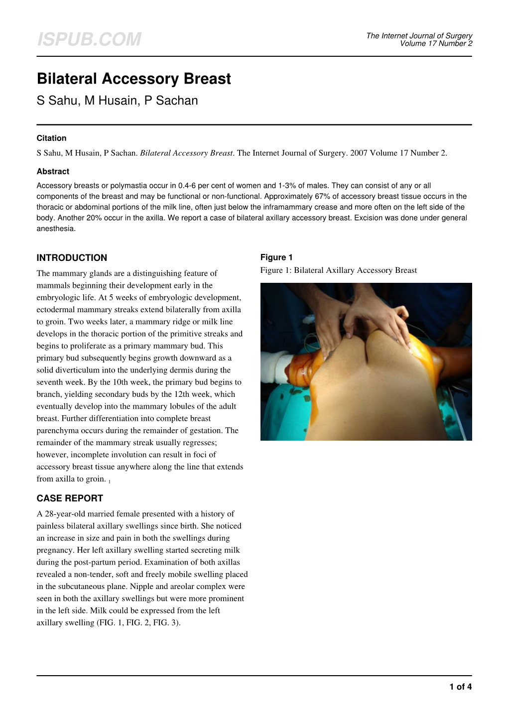 Bilateral Accessory Breast S Sahu, M Husain, P Sachan