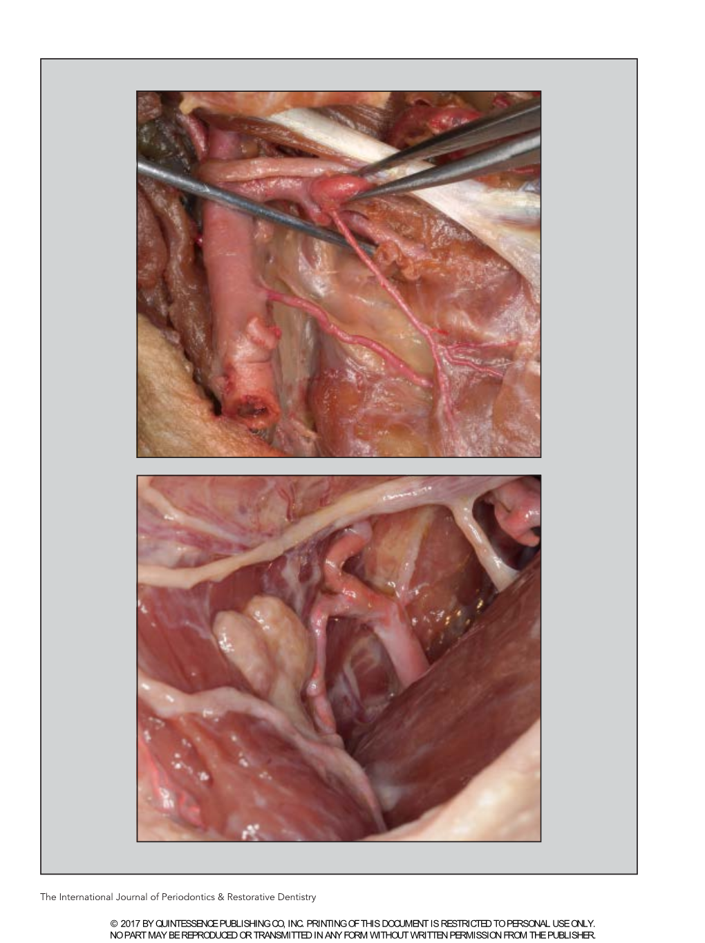 The International Journal of Periodontics & Restorative Dentistry