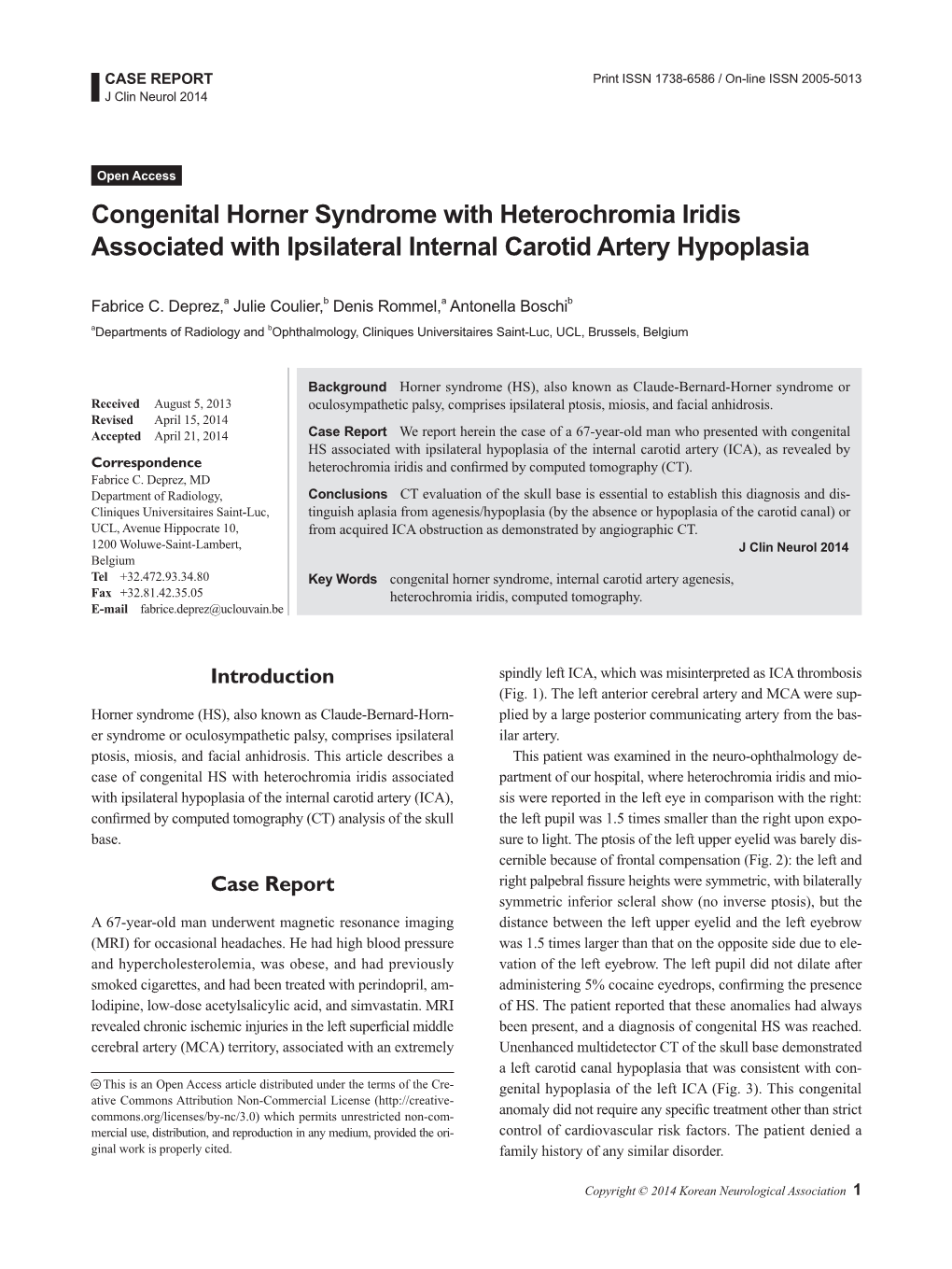 Congenital Horner Syndrome with Heterochromia Iridis Associated with Ipsilateral Internal Carotid Artery Hypoplasia